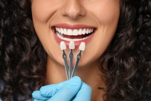 Dental Veneers San Antonio